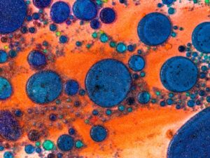 Infection Surveillance Systems How Data Helps Us Predict and Prevent Outbreaks