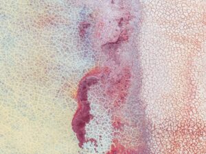 Infections That Linger Chronic Illnesses Caused by Long-Term Viral Presence