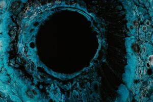 Superbugs on the Rise When Common Infections Become Life-Threatening Emergencies
